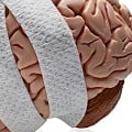 Can you fully recover from a serious brain injury?