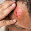 Can a head injury cause symptoms years later?