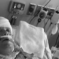 Traumatic brain injury treatment houston tx?