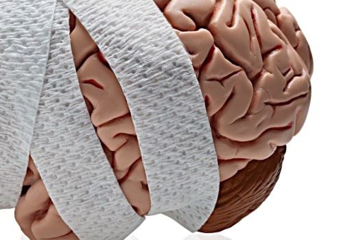 Can you fully recover from a serious brain injury?