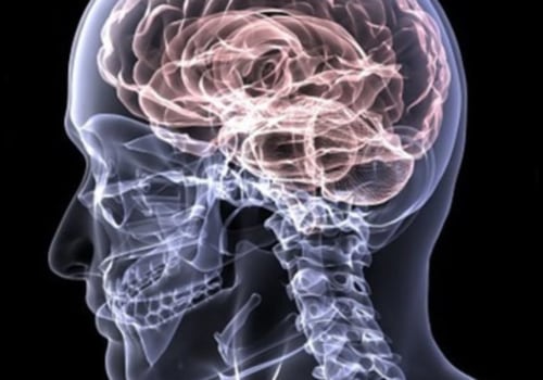 What is considered mild traumatic brain injury?