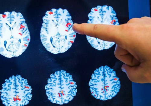 Can a brain injury appear years later?