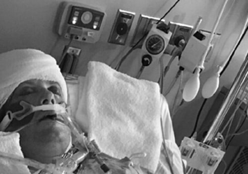 Do people with brain injuries die sooner?