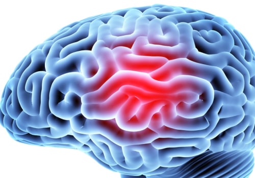 Treatment of traumatic brain injury?